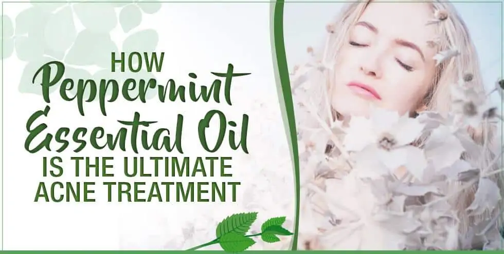 How Peppermint Essential Oil Is The Ultimate Acne Treatment
