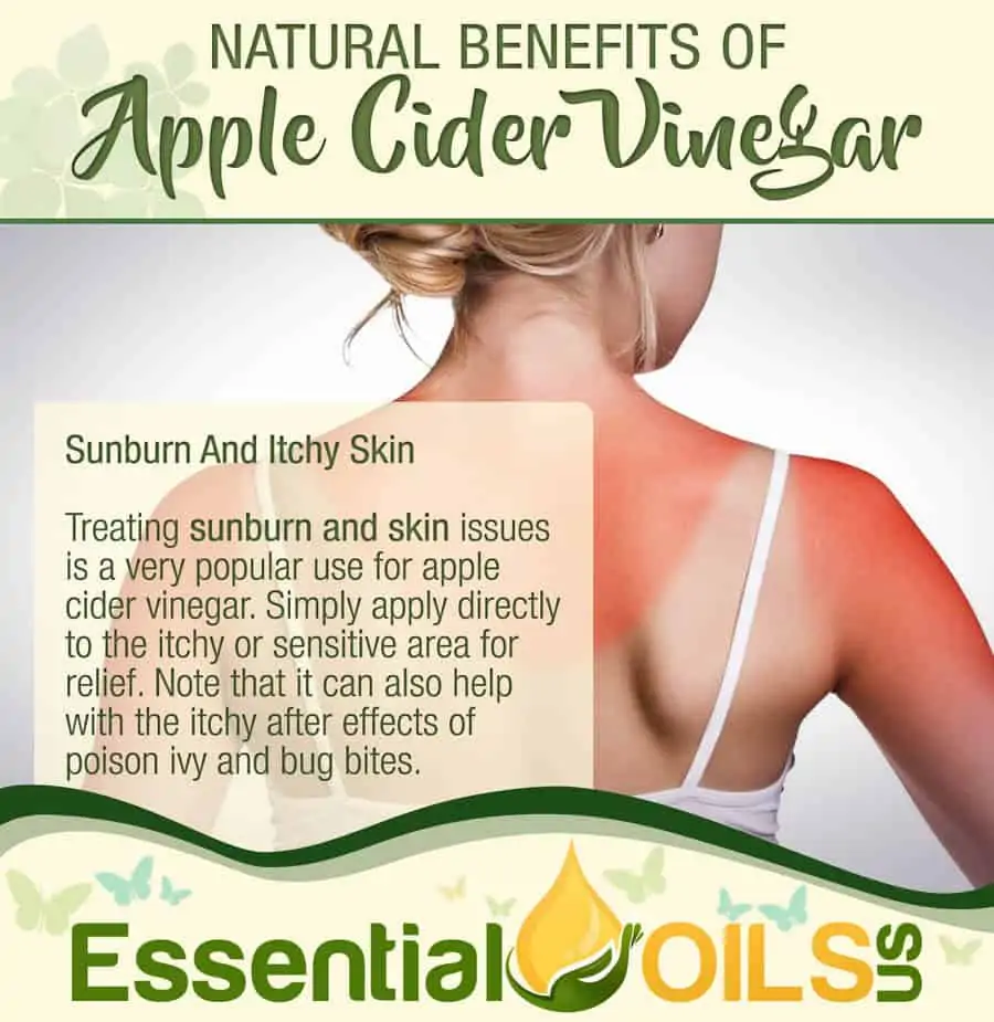 Apple Cider Vinegar Benefits - Sunburn And Itchy Skin